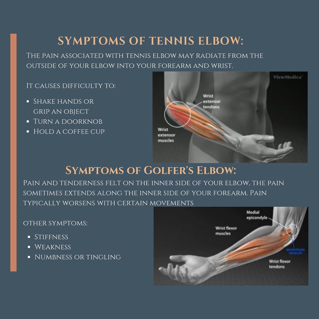 Lateral Epicondylitis Elbow Symptoms