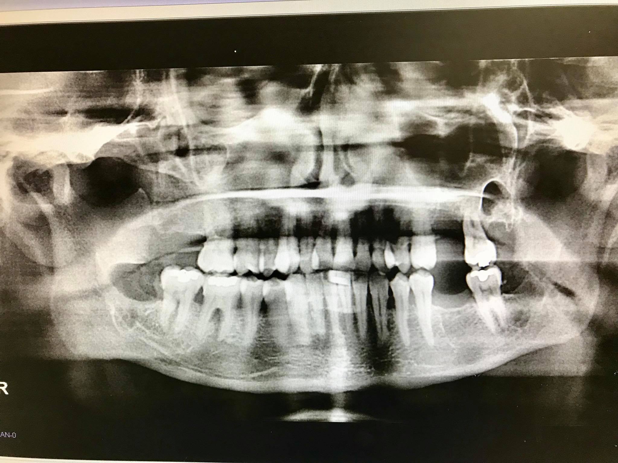 This post op... - Implant & Maxillofacial Surgical Center