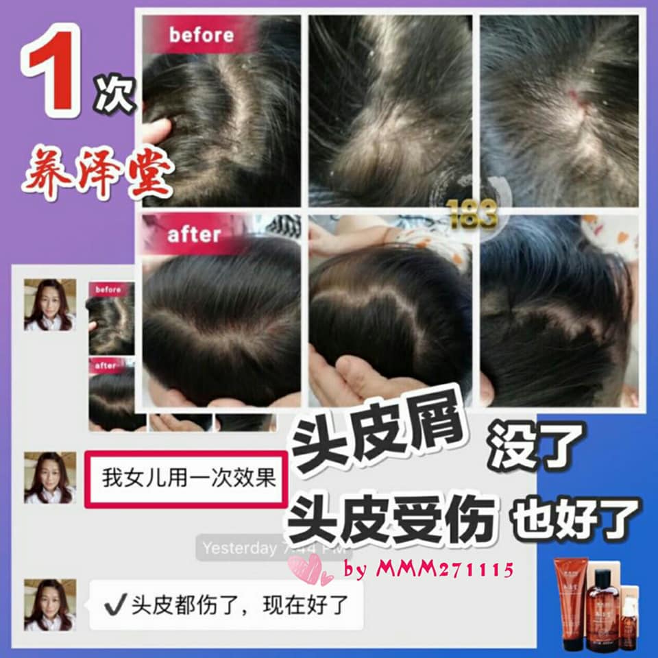 章光101养泽堂洗护养发配套 | Batu Kikir