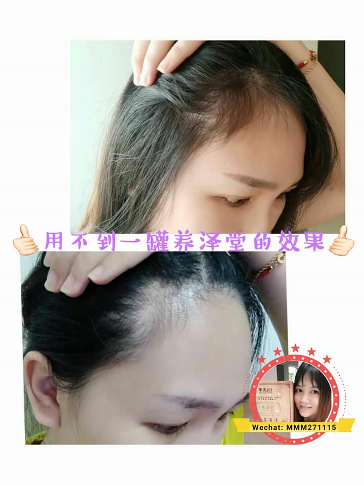 章光101养泽堂洗护养发配套 | Batu Kikir