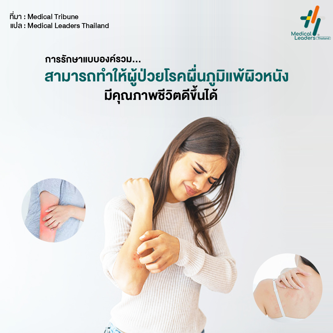 การรักษาแบบองค์รวมสามารถทำ... - Medical Leaders Thailand - MLT