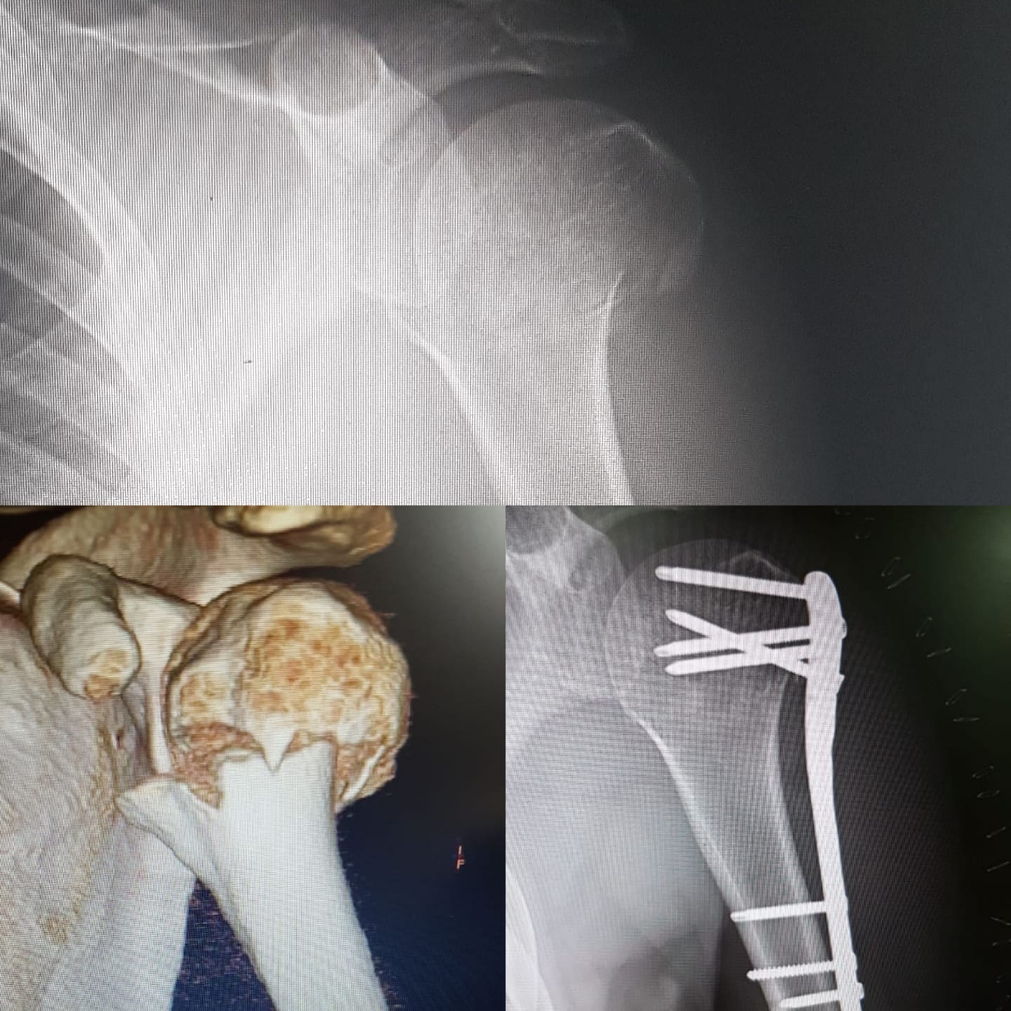 Dr. Murillo Traumatología, Ortopedia y Cirugía Articular