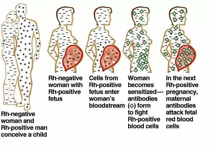 Rh incompatibility occurs when a... - Jadhav Homeo Clinic | Facebook