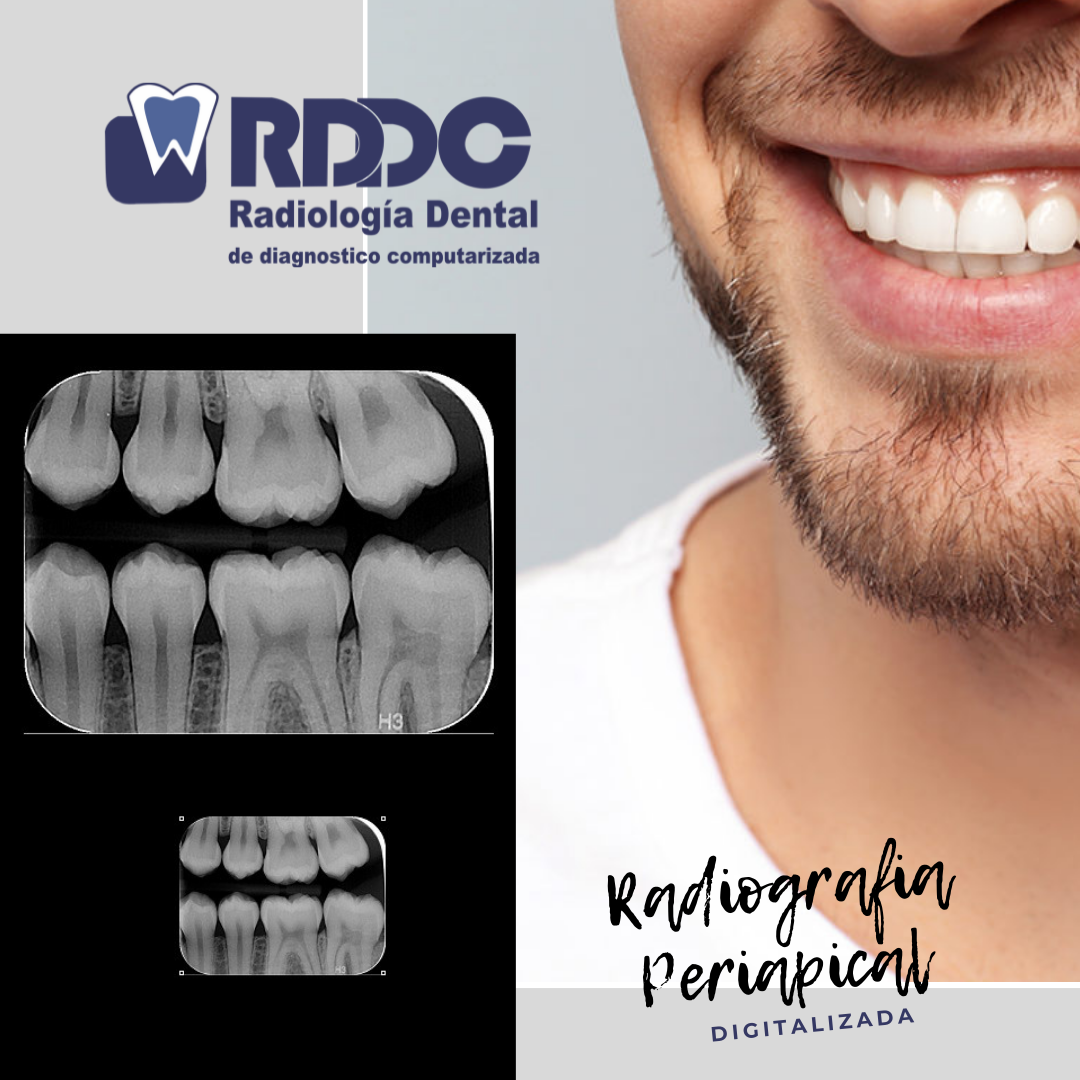 ☢RADI... - RDDC Radiología Dental de Diagnóstico Computarizada | Facebook