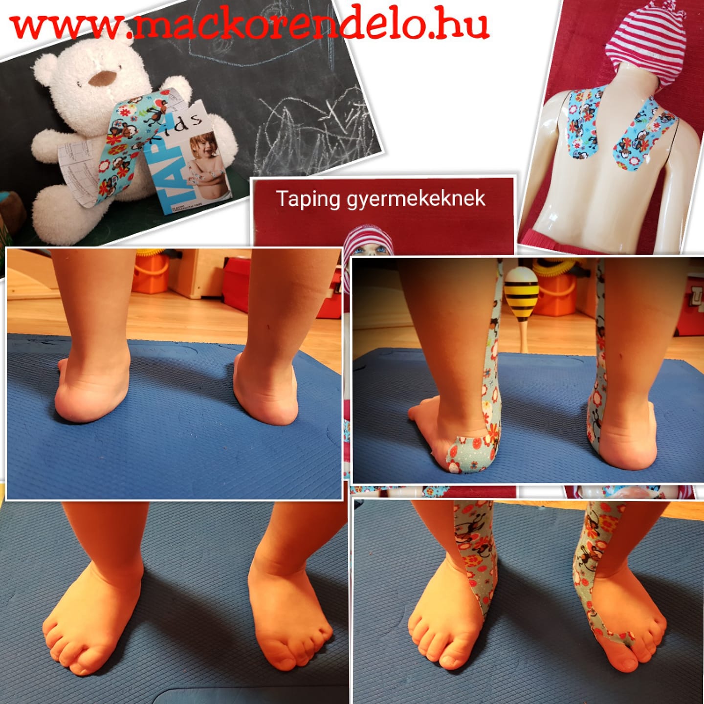 Mackórendelő - #bokasüllyedés #bokabedőlés #lúdtalp #kinesiotapegyerek ...