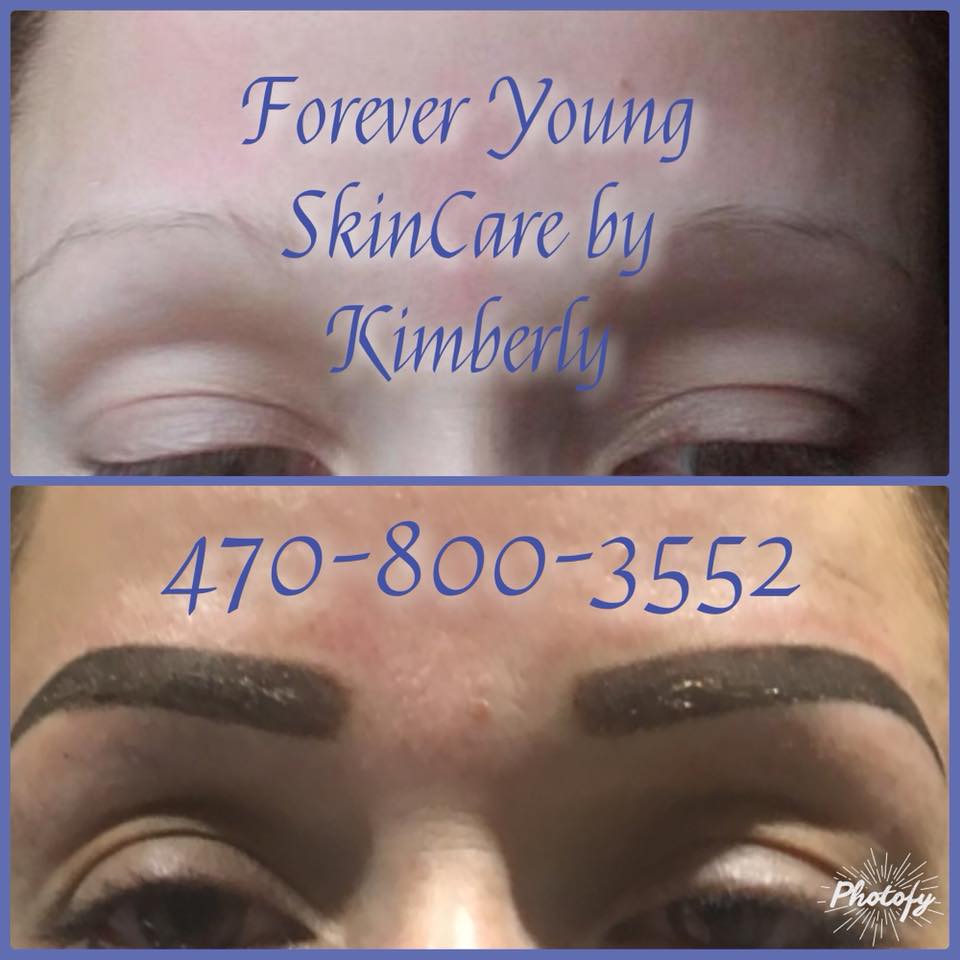 Forever Young Skin Care Laser By Kimberly Posts Facebook