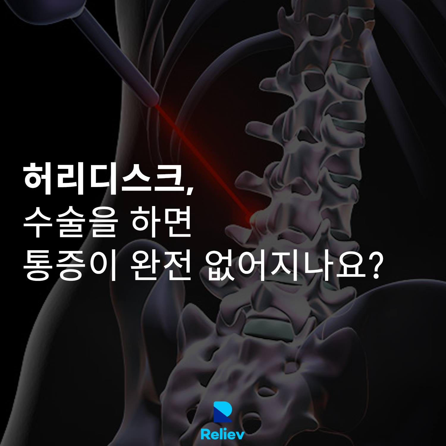 릴리브 Reliev - 수술 받으면 허리통증은 없어지나요? ⠀ 단기적으로 통증이 줄어들 순 있지만...