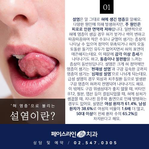페이스라인치과 - 피로와 면역력 저하로 혀에 발생하는 염증, 설염(舌炎)에 걸려 병원을 찾는 사람이 한해...