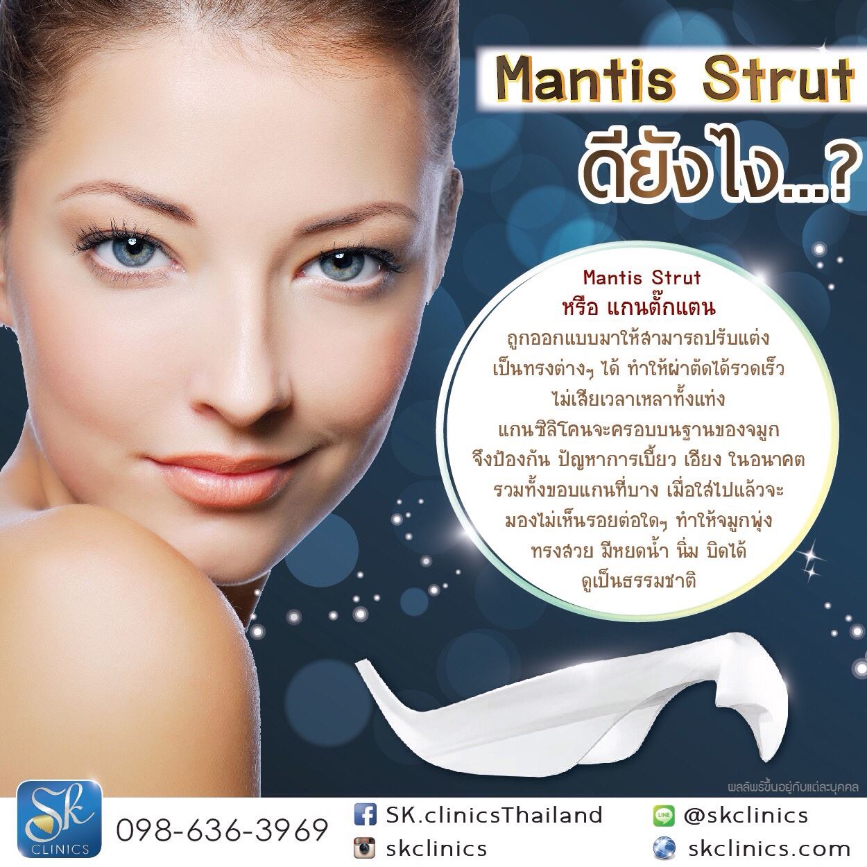 เกร็ดความรู้วันนี้... 💒 Mantis Strut... - Sk clinics ขอนแก่น