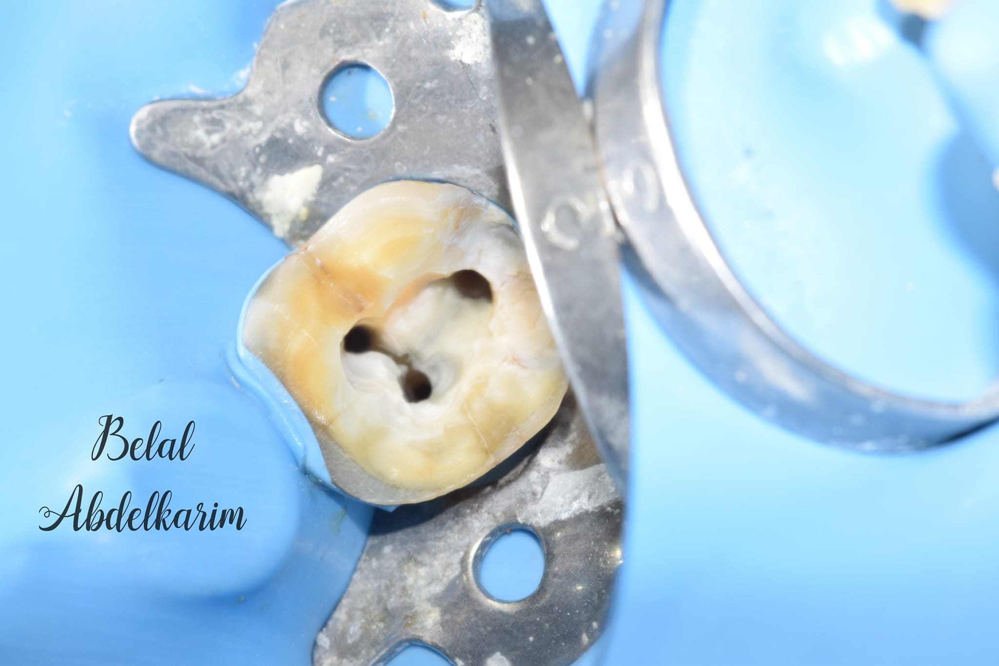 Dr. Belal Abdelkarim Dental Clinic عيادة د. بلال عبد الكريم لطب الأسنان