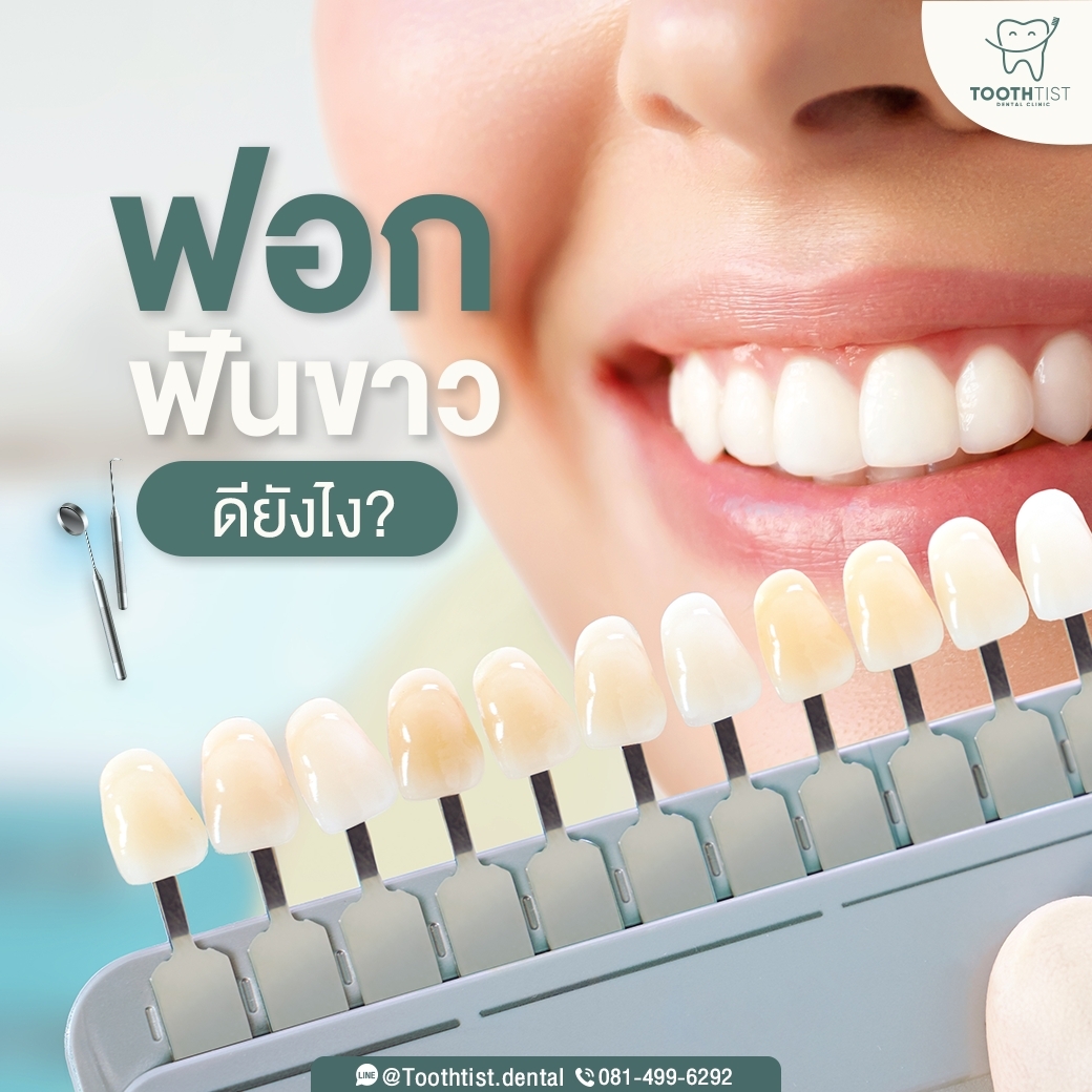 ฟอกฟันขาวแล้... - Toothtist Dental Clinic คลินิกทันตกรรมทูธทีส