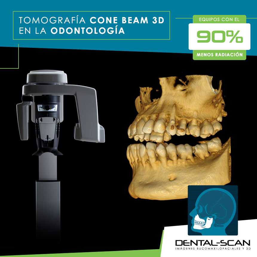 Dental Scan - La tomografía Cone Beam 3D en odontología es...