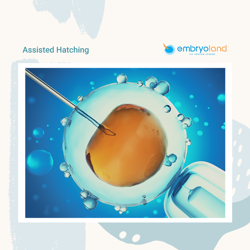 👩‍⚕️Assisted hatching is... - Embryoland - IVF Center Athens