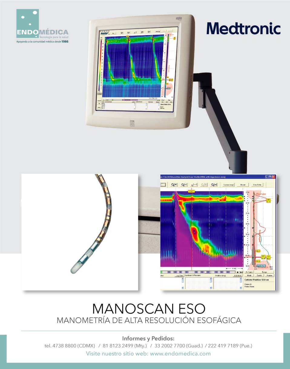 [#GASTROENTEROLOGIA] MANOSCAN ESO... - Endomedica SA de CV | Facebook