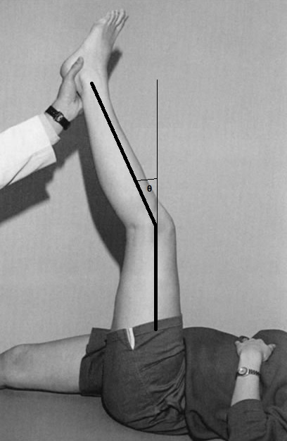 OrthoMan Page - how to measure the popliteal angle. A normal popliteal ...