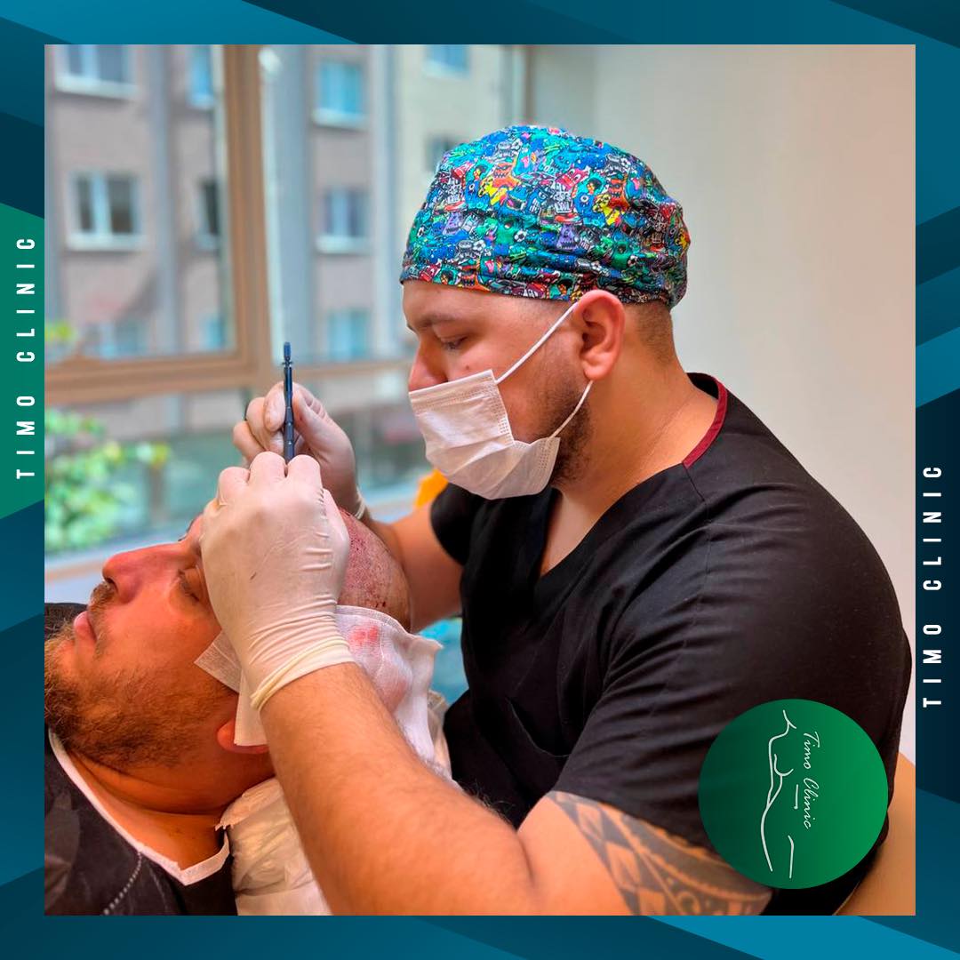 FUE... - Timo Clinic - Hair Transplant & Cosmetic Surgery