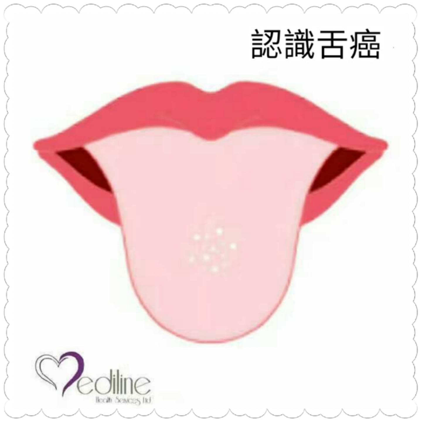 琸盈體檢顧問有限公司 - 【認識舌癌】...