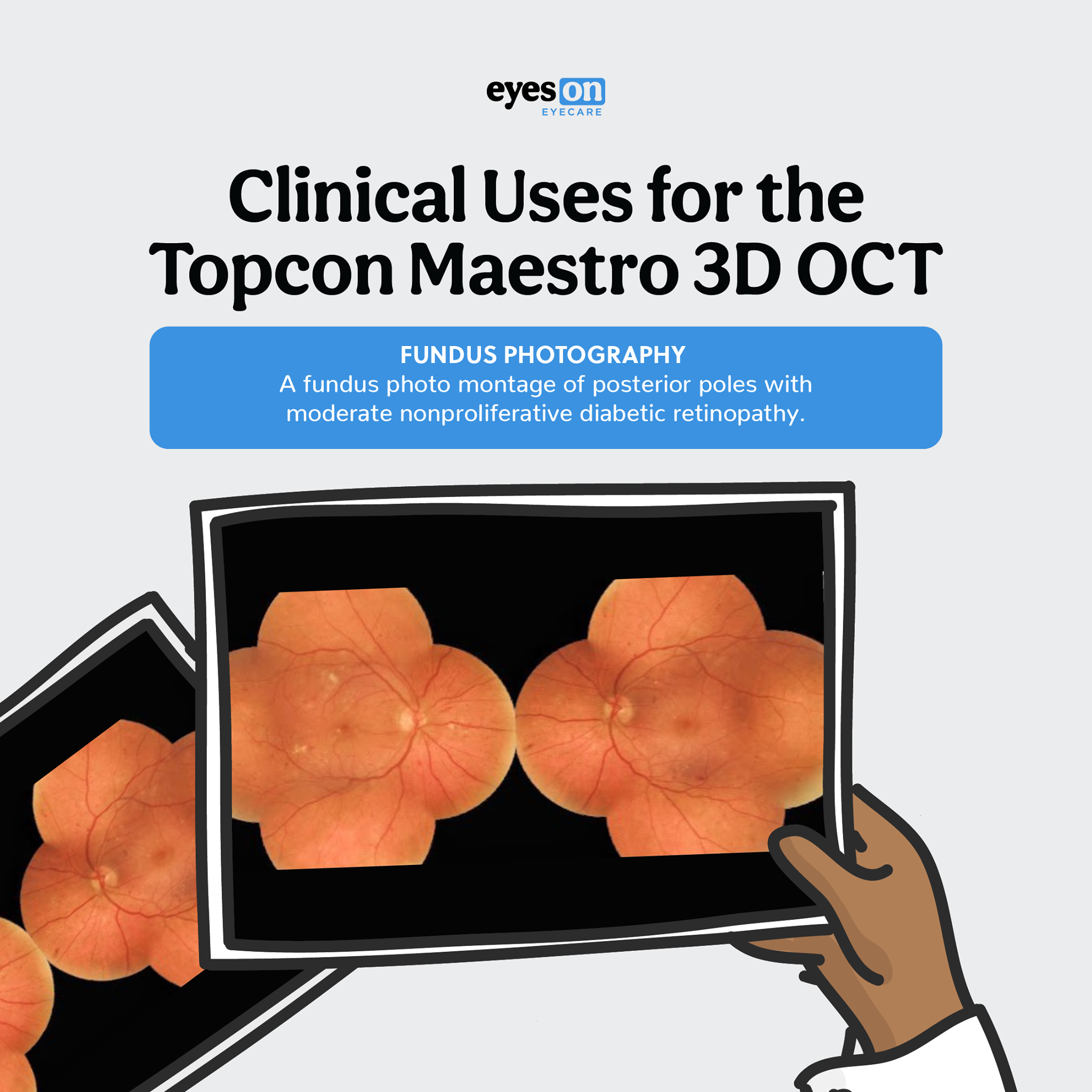The Topcon Maestro 3D OCT... - Eyes On Eyecare Optometry | Facebook