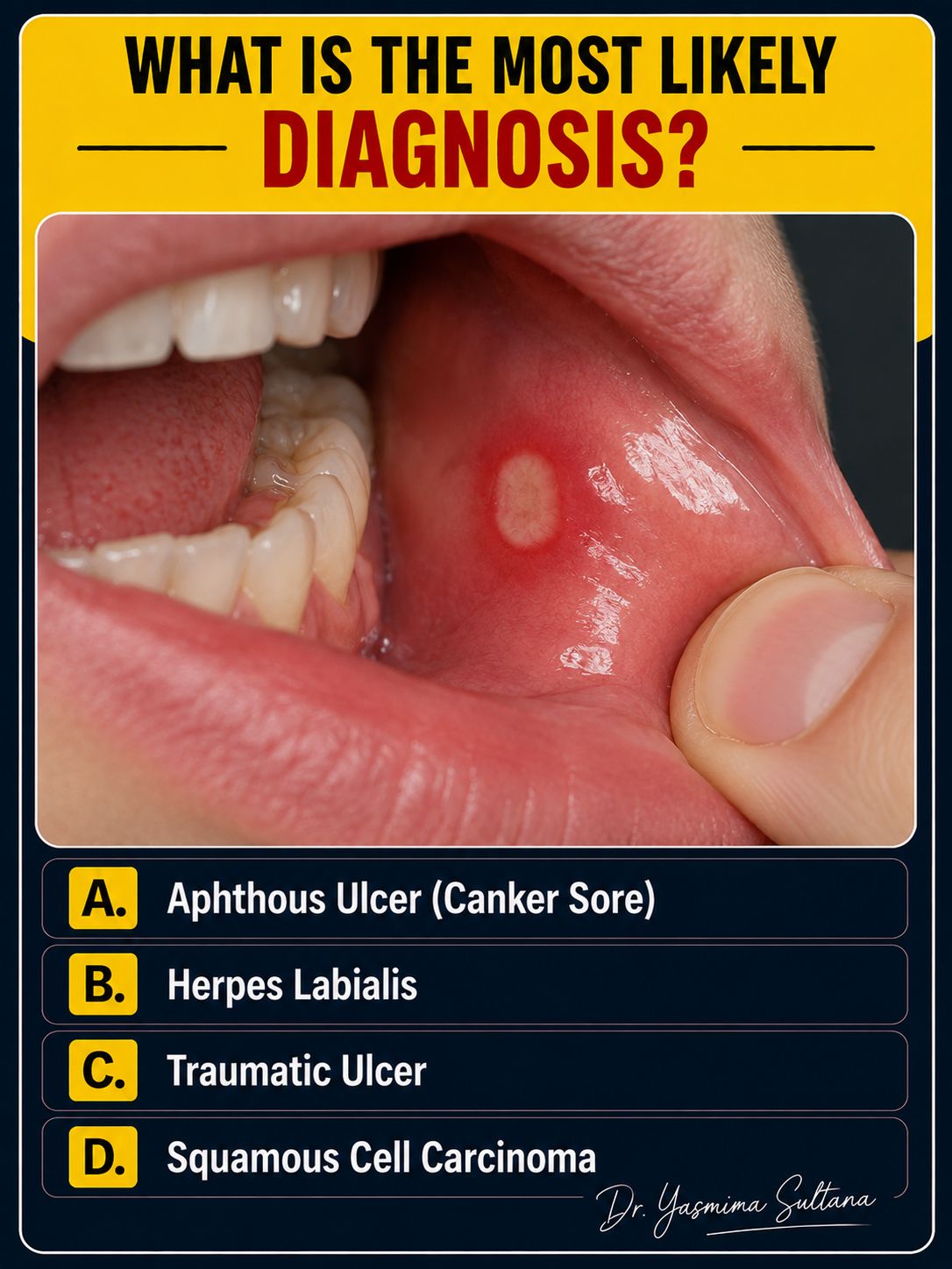 What are the yellow chunks coming out of a lip laceration?