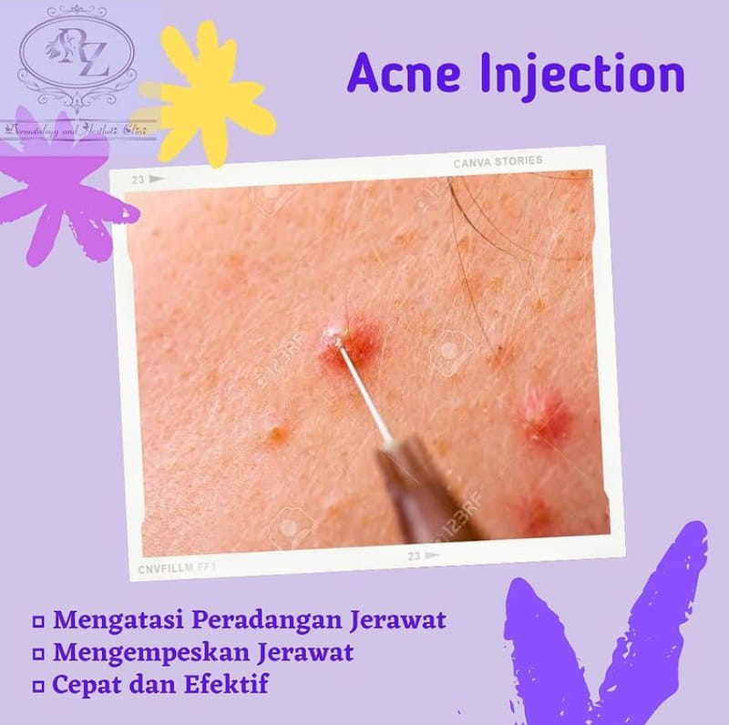 RZ Dermatology and Aesthetic Clinic | Lubuklinggau