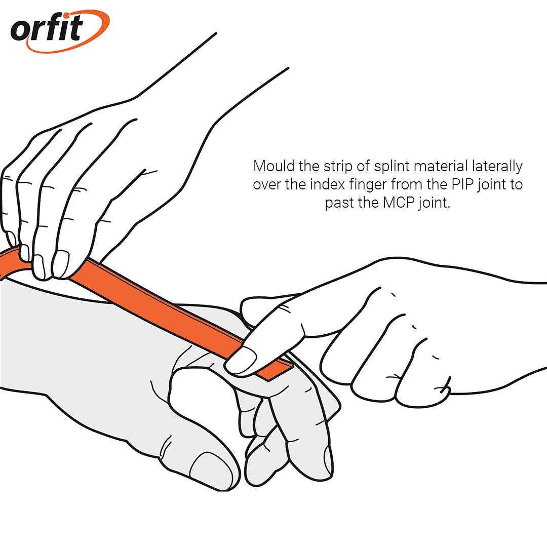 The ulnar drift orthosis prevents the... - Orfit Industries