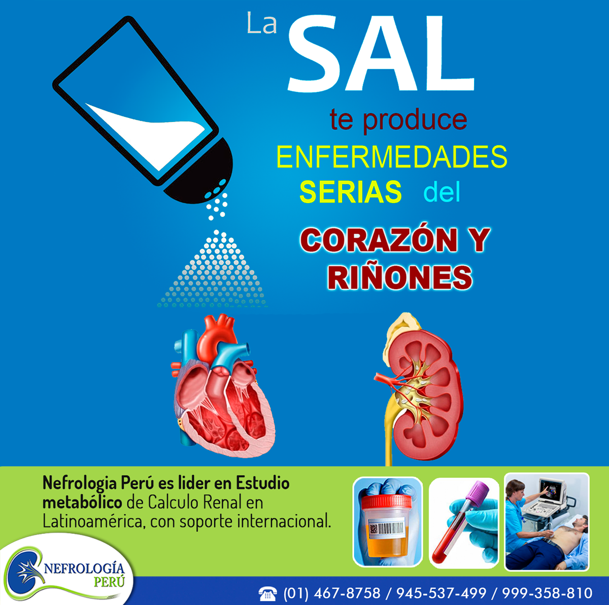 Nefrología Perú - 💢 EL CONSUMO EN EXCESO DE SAL ES NOCIVO PARA NUESTRA ...