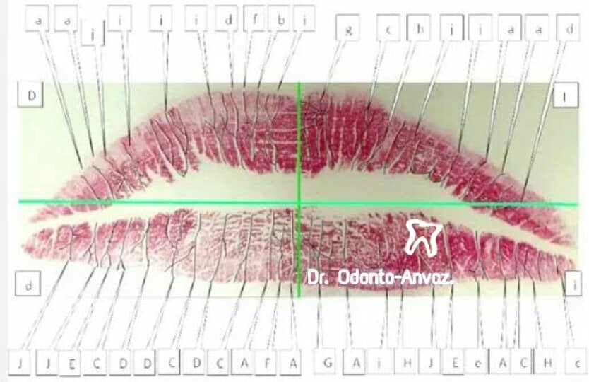 ⚠Odontología Forense QUEILOSCOPÍA En... - Dr. Odonto-Anvaz | Facebook