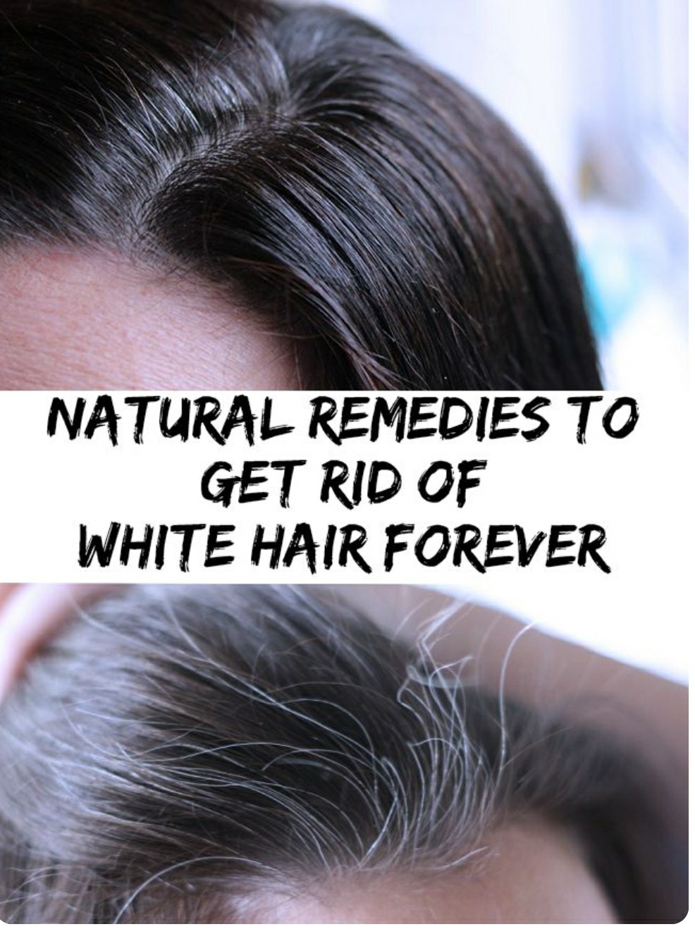 White hair is often seen as a sign of aging, but it can appear early due to several factors. Genetics, stress, hormonal changes, and nutritional deficiencies all affect melanin production, the pigment