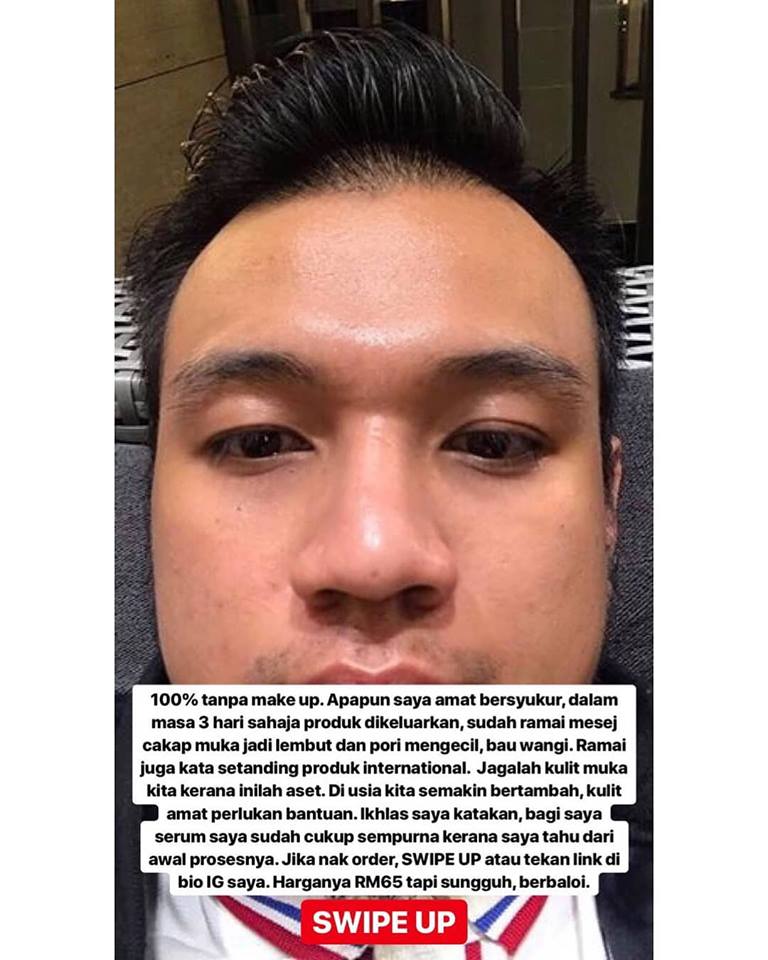 Iba Serum Merawat Kulit Muka Anda Home Facebook