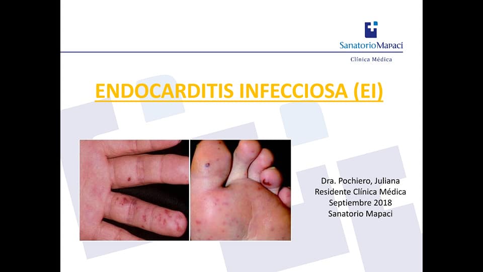 Hoy clase sobre... - Clínica Médica Sanatorio Mapaci | Facebook