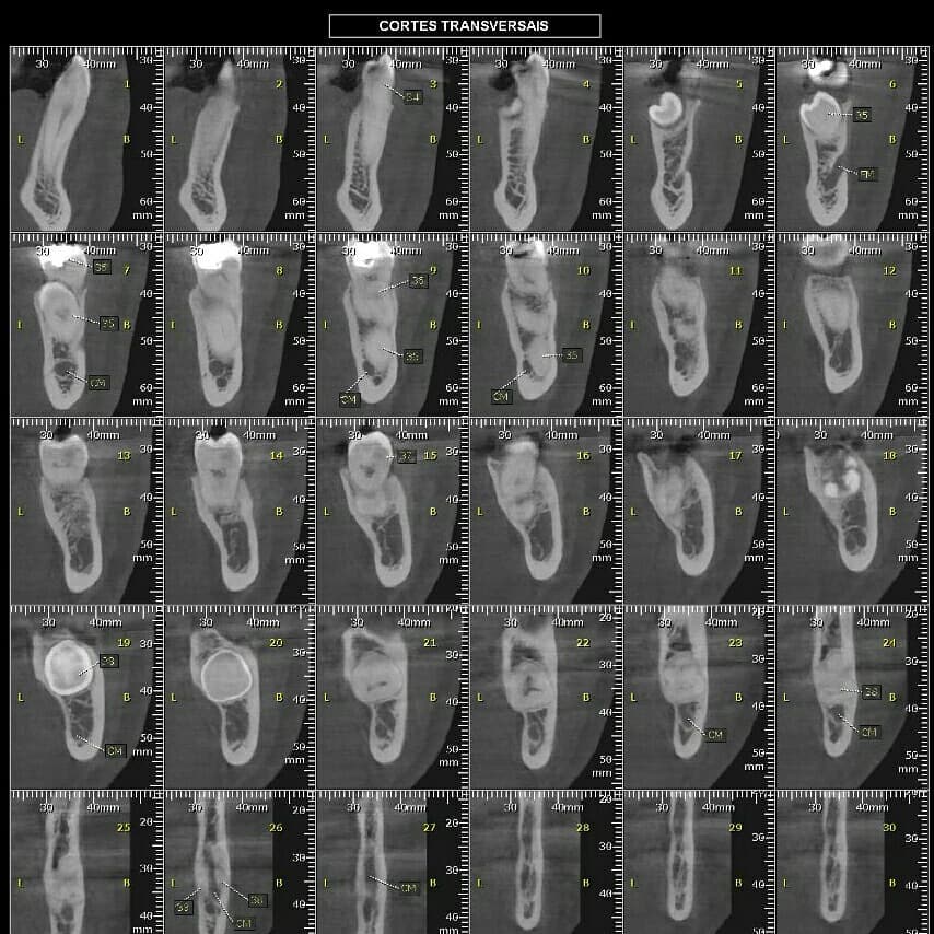 Ultrarad -... - Ultrarad - Radiologia Odontológica Digital