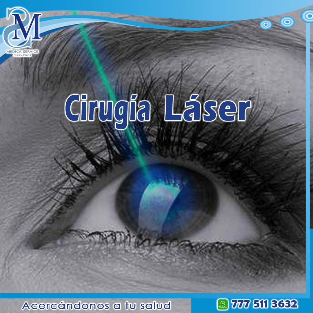 El LASIK es un tipo de cirugía... - Médica Service Cuernavaca | Facebook