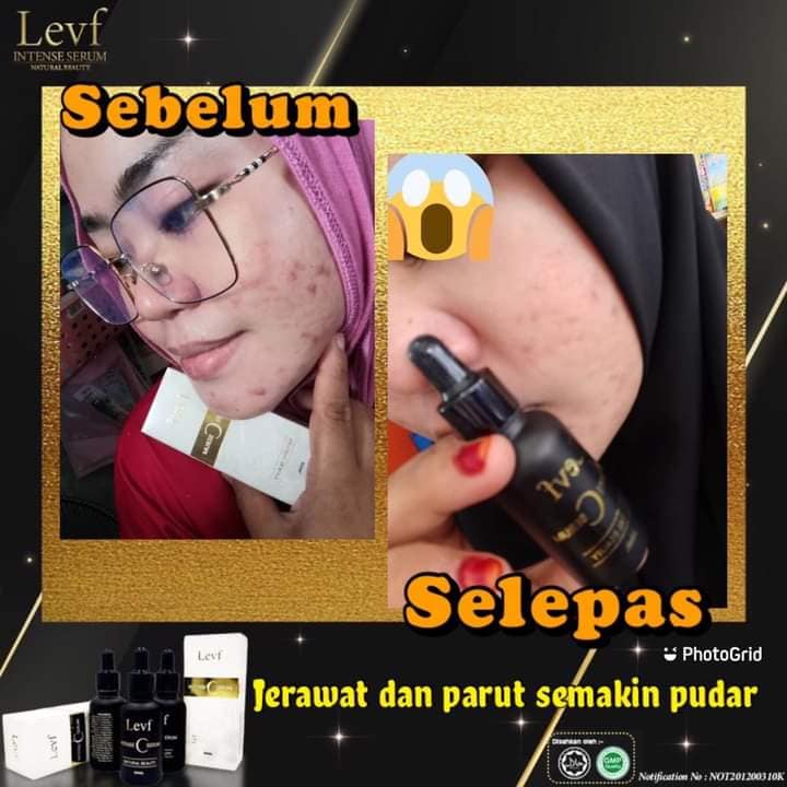 LEVF INTENSE SERUM... - Wonder Fruity Nibong Tebal