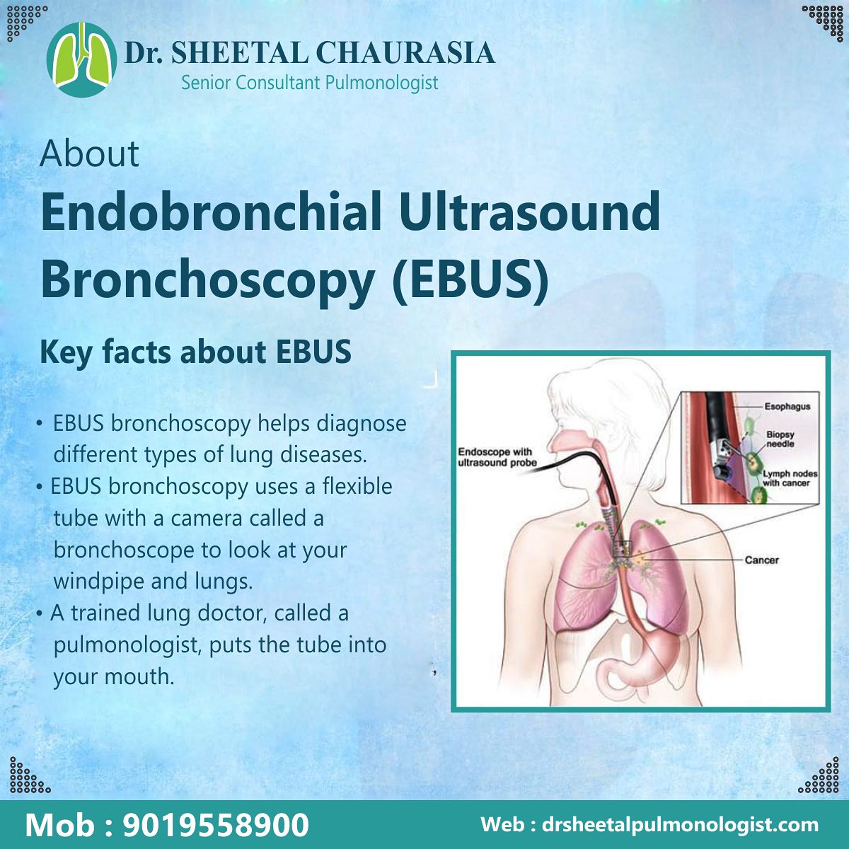 Dr. - About endobronchial ultrasound bronchoscopy (EBUS) Key 🔑facts ...