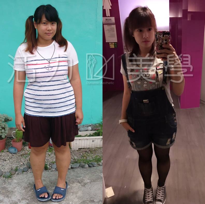 活力美學 窈窕a瘦逆齡保養專家 - 淑鈴分享：曾經試過無數方式瘦了又胖胖了又瘦，變成溜溜球體質>