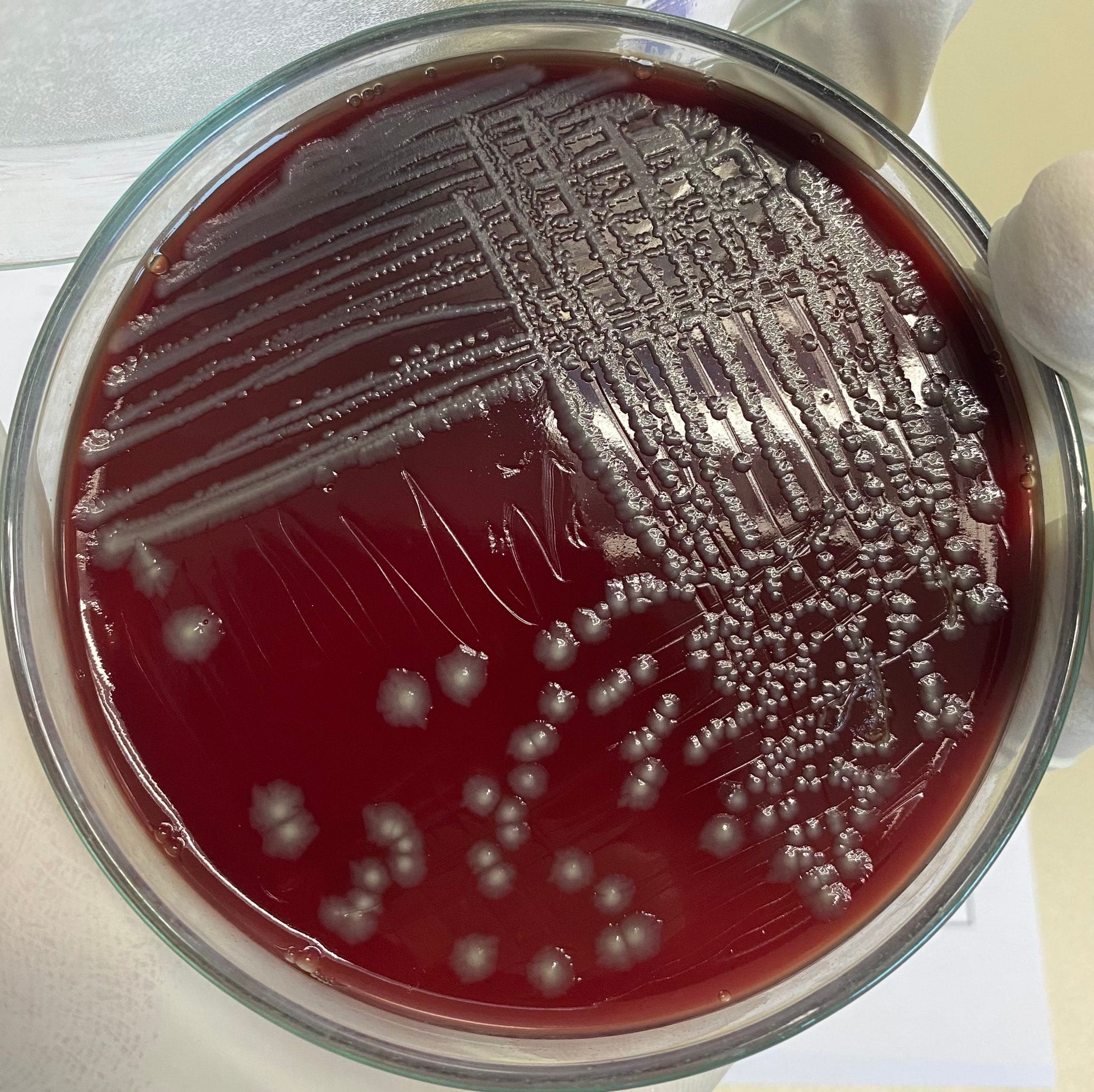 microbenotes-blood-agar-ba-the-gray-colonies-shown-on