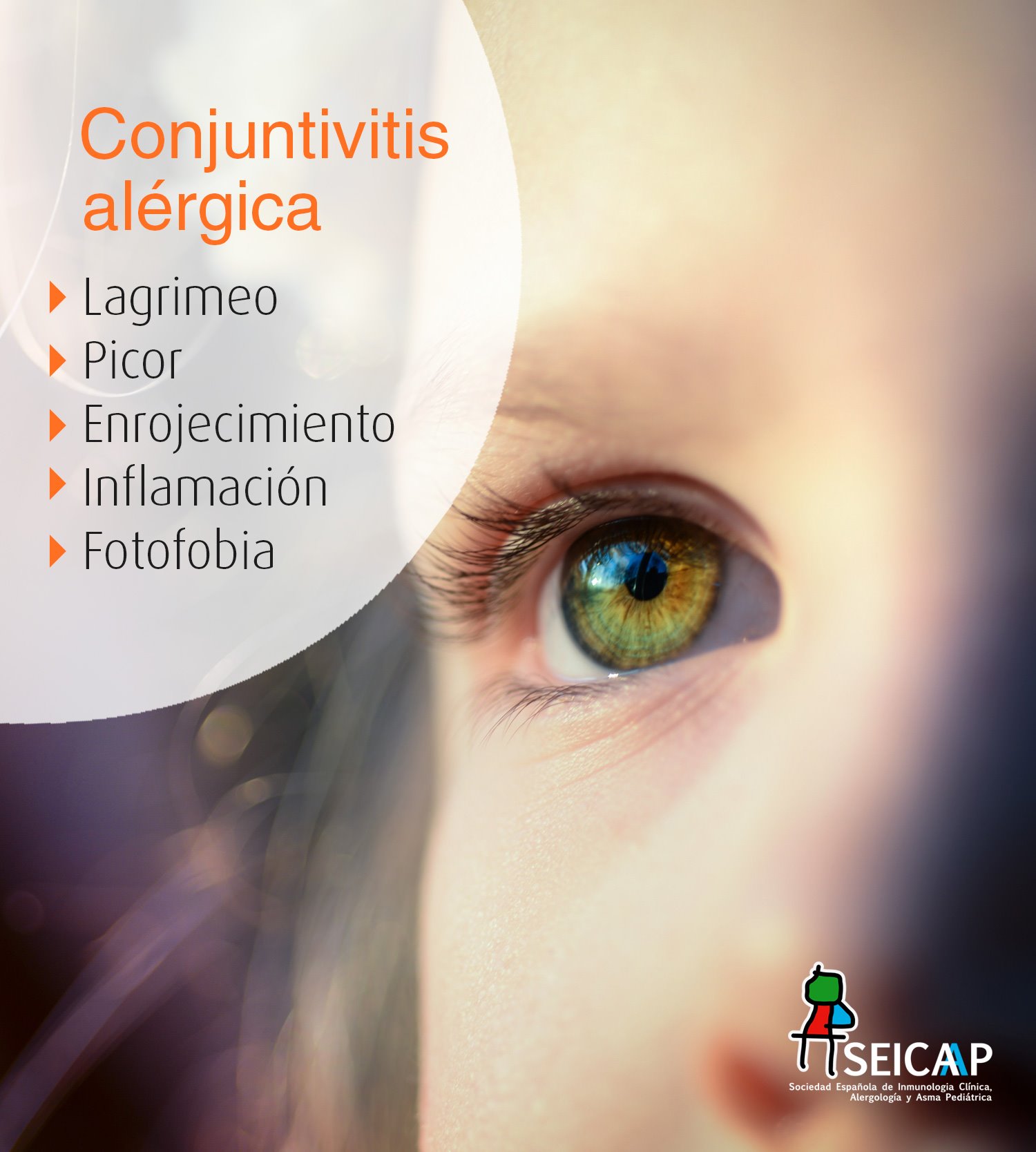 SEICAP - ¿Cuáles son los síntomas de la conjuntivitis... | Facebook