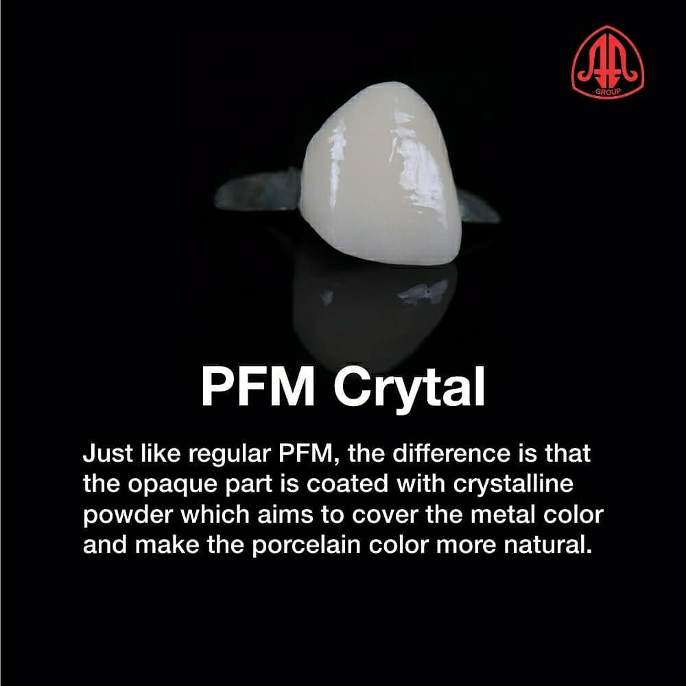 PFM Crystal, a type of PFM... - Asia Afrika Dental Laboratory