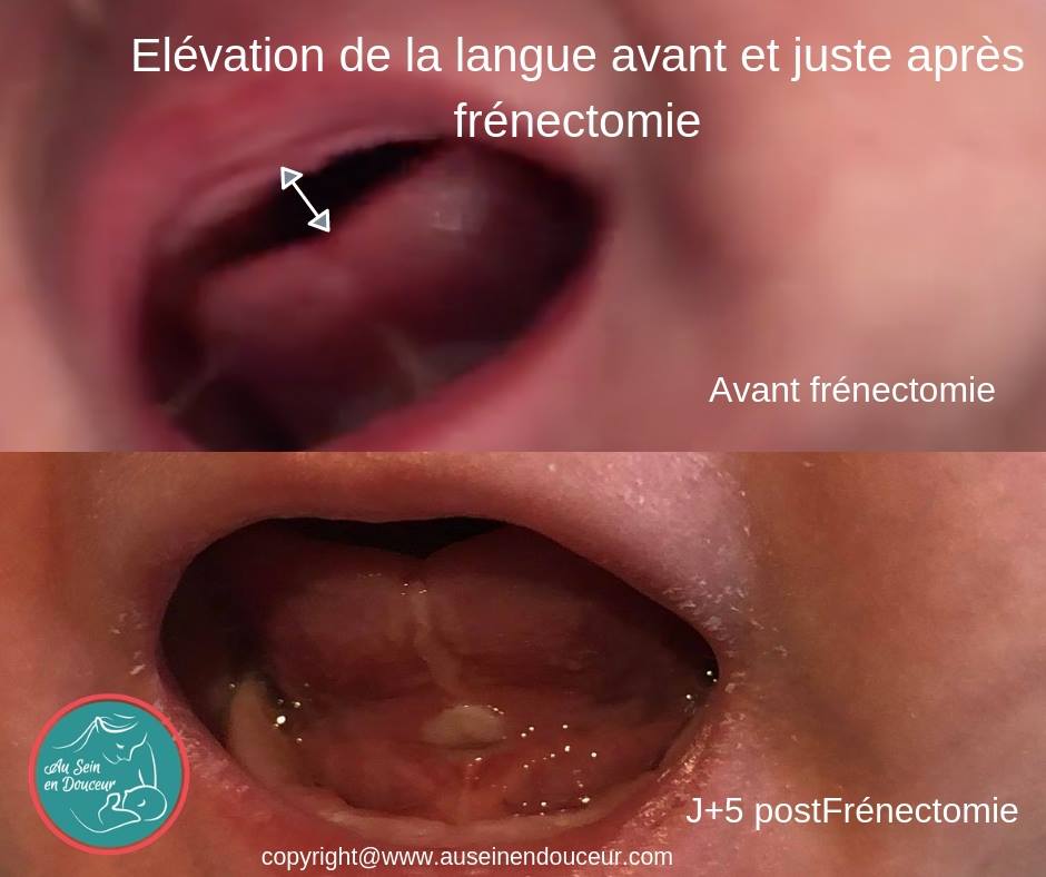 Elevation De La Langue L Institut Au Sein En Douceur Facebook