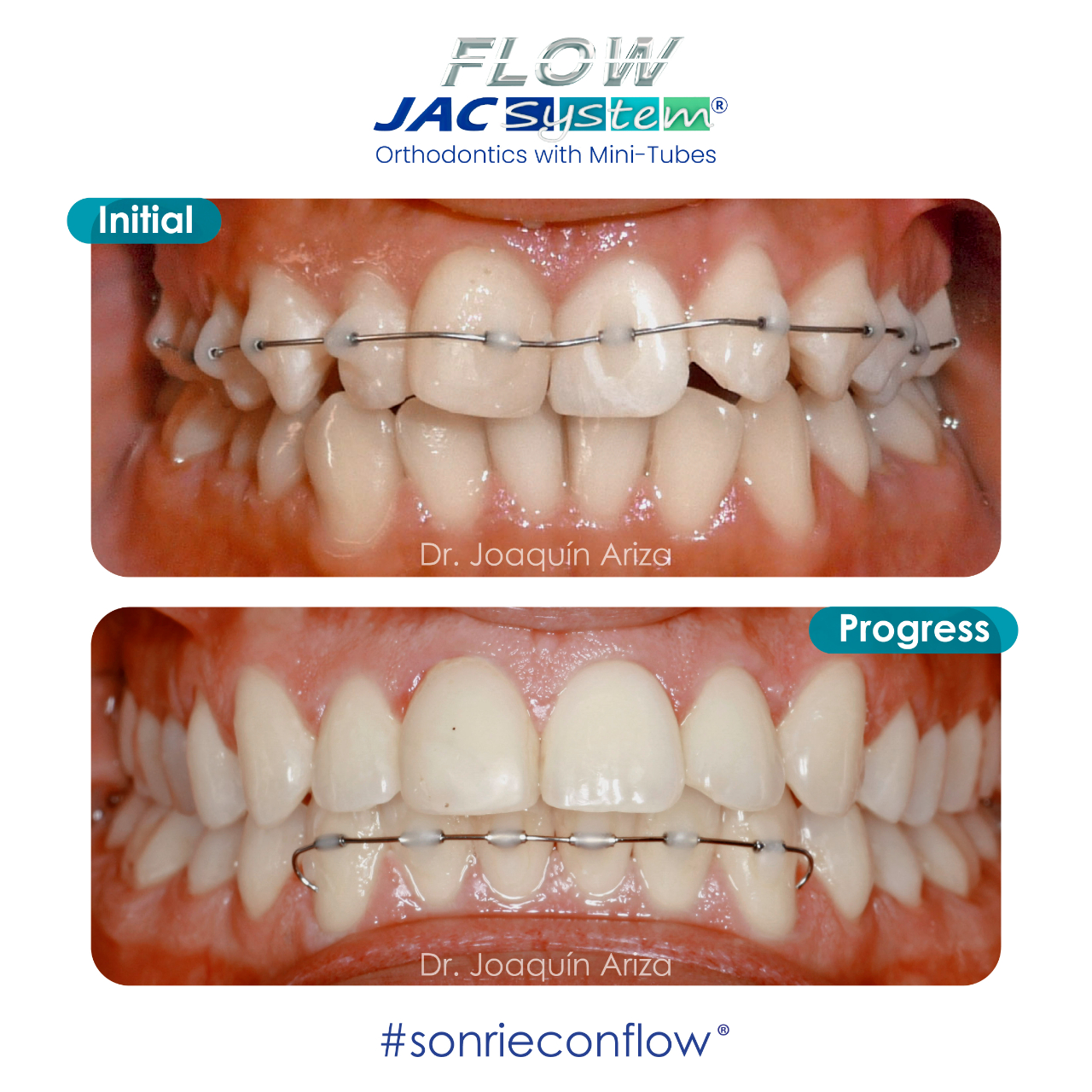 Flow Jac System - Home