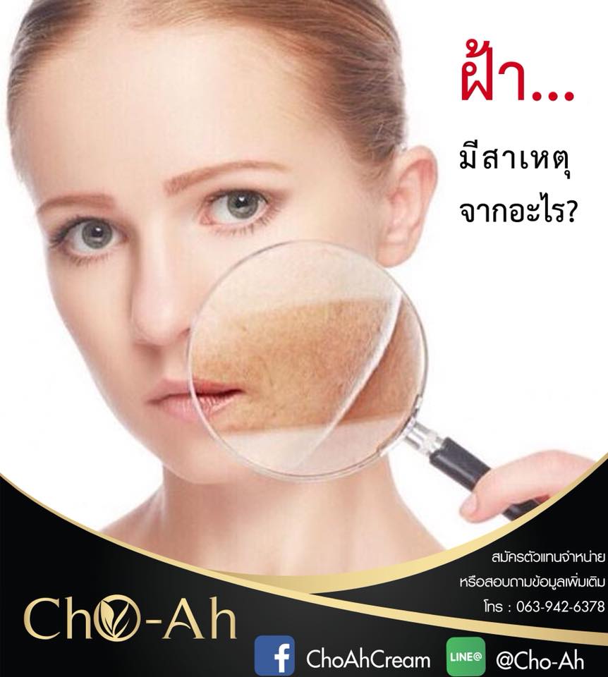 Cho-Ah Cream - หากคุณ ไม่ทากันแดดปกป้องผิว...... | Facebook