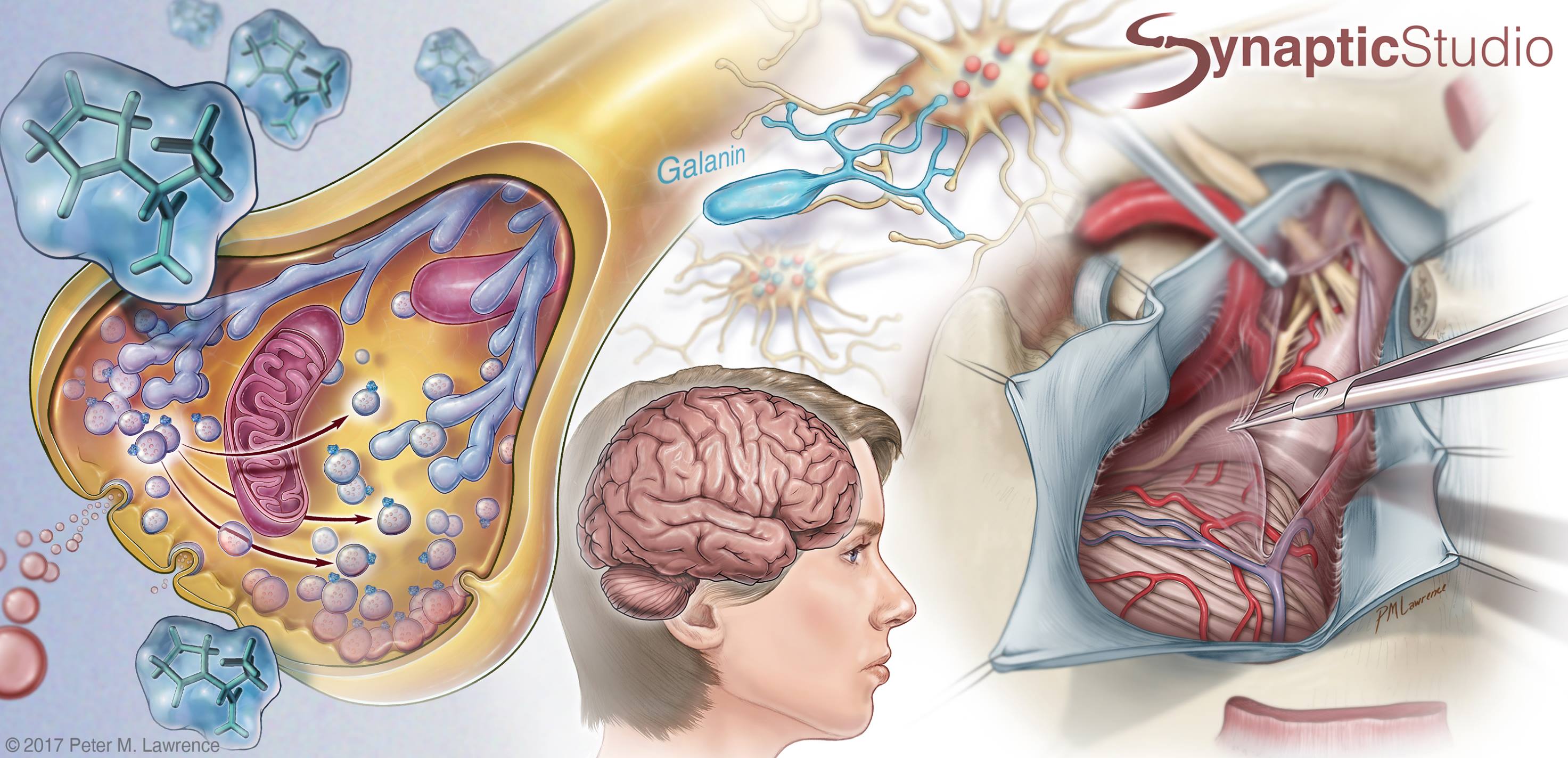The Neurosurgical Atlas - #GrandRounds: 