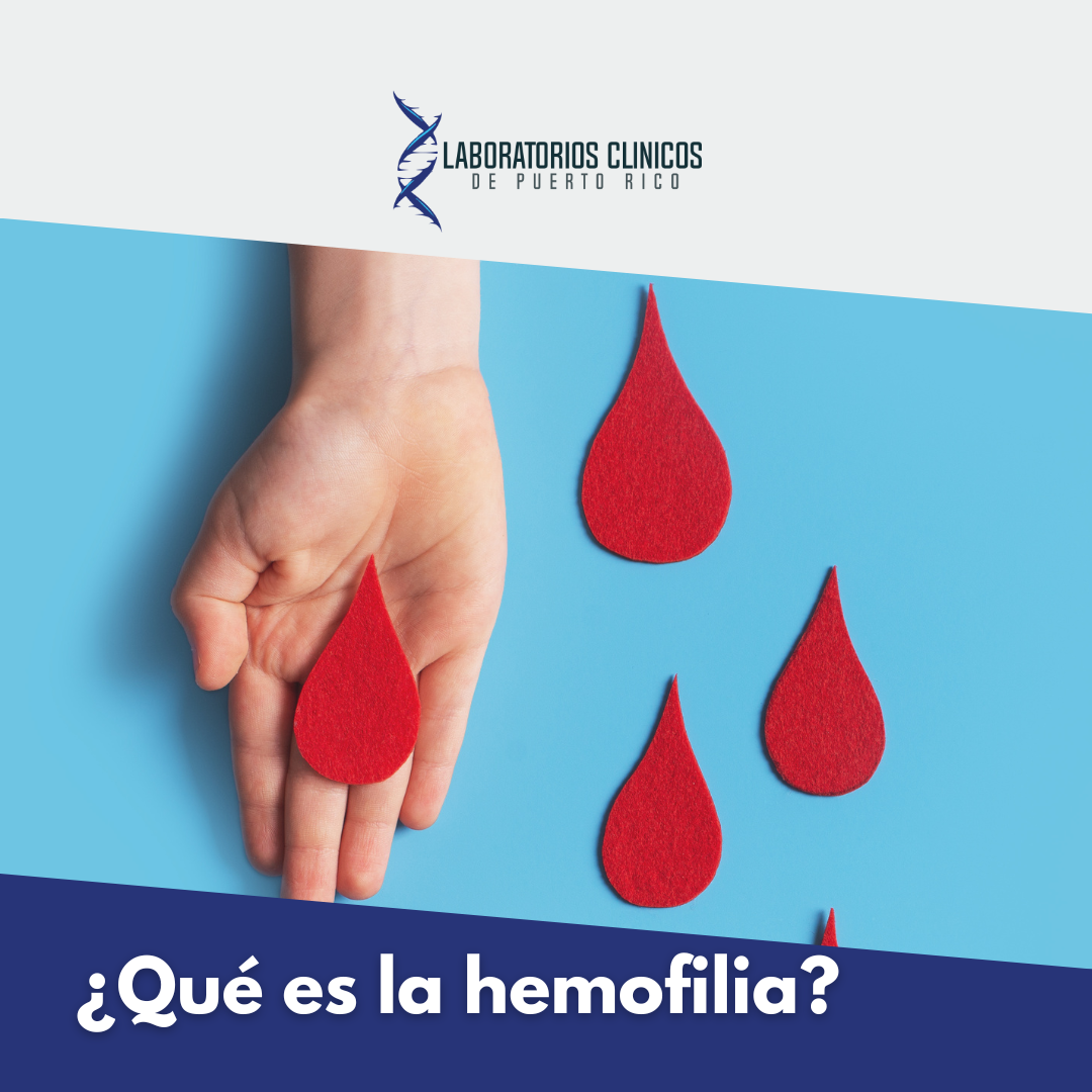 🤷🏼‍♀️🤷🏻‍♂ ¿Qué es la... - Laboratorio Clínico Los Colobos