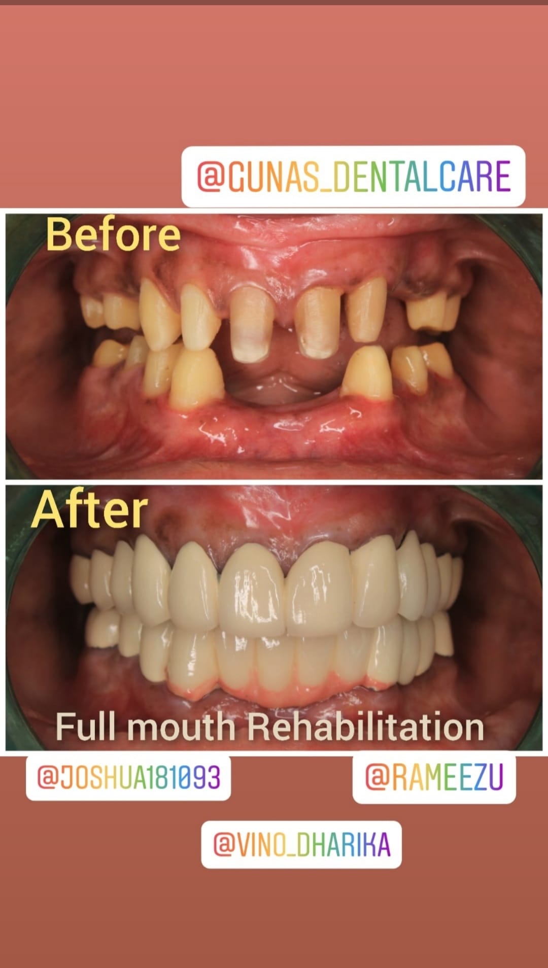 Guna's Dental care Pedappai