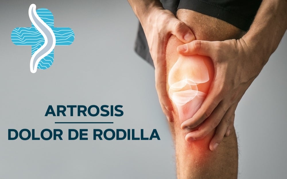 👉 La artrosis de... - Centro Médico Especializado Los Álamos