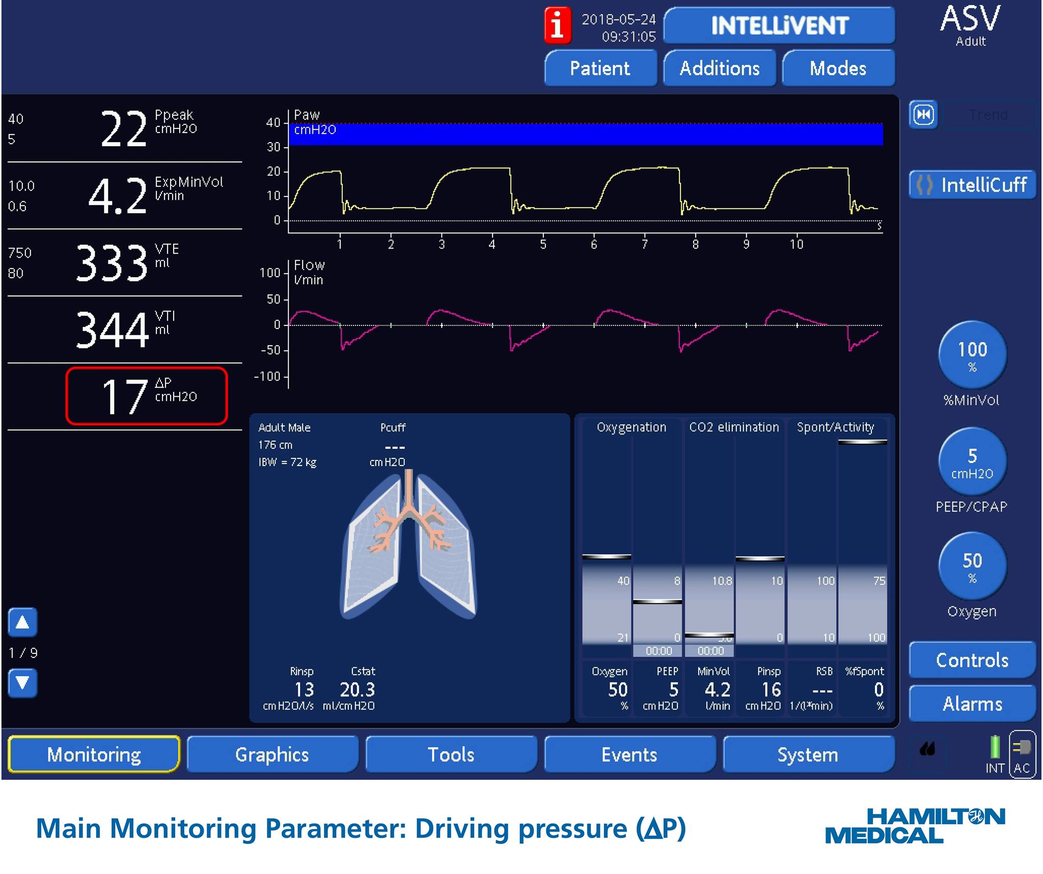 #New software features for... - Hamilton Medical AG
