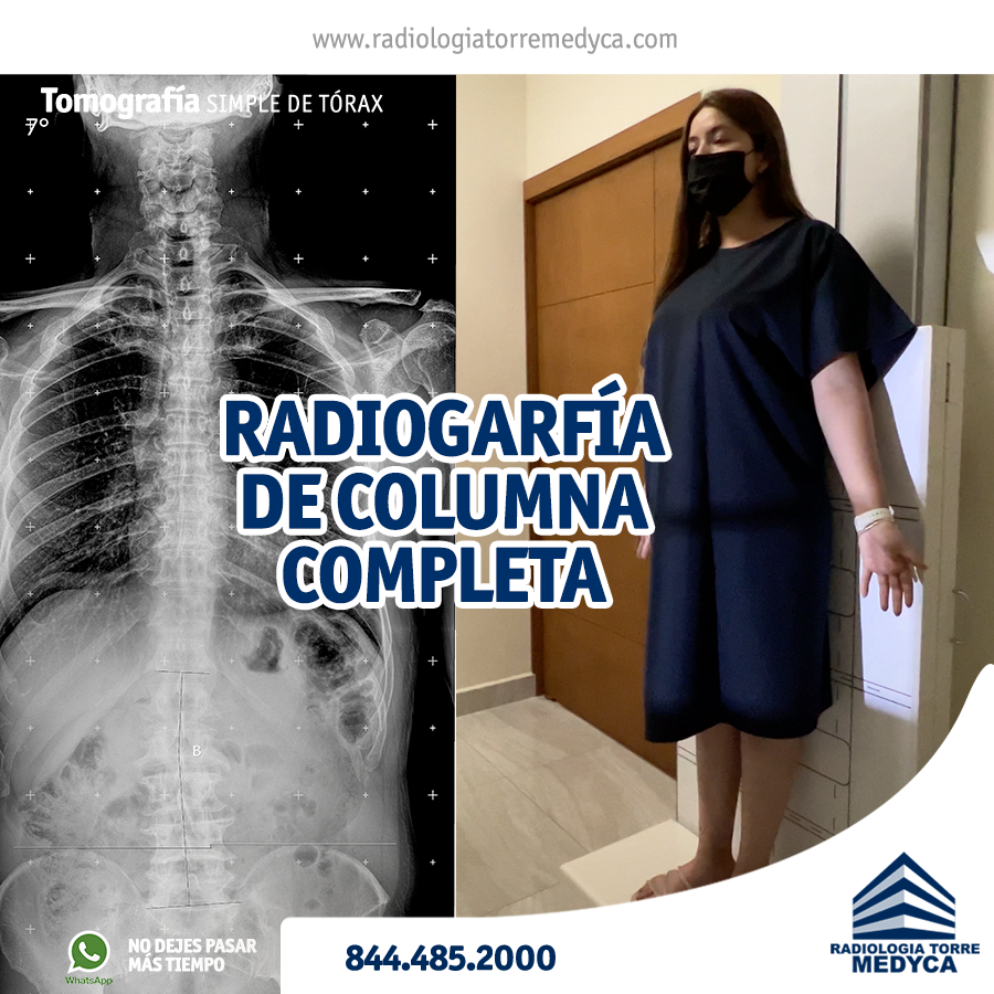¿Qué es Radiografía de Columna... - Radiologia Torre Medyca | Facebook