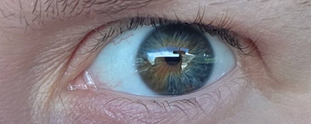 Eye color? Check put the last 2 in natural light! Are they grey?