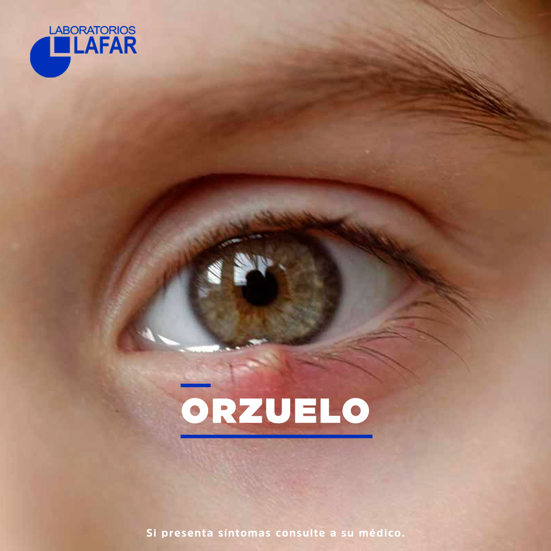 ¿Conoces que es un... - Laboratorios LAFAR Internacional | Facebook