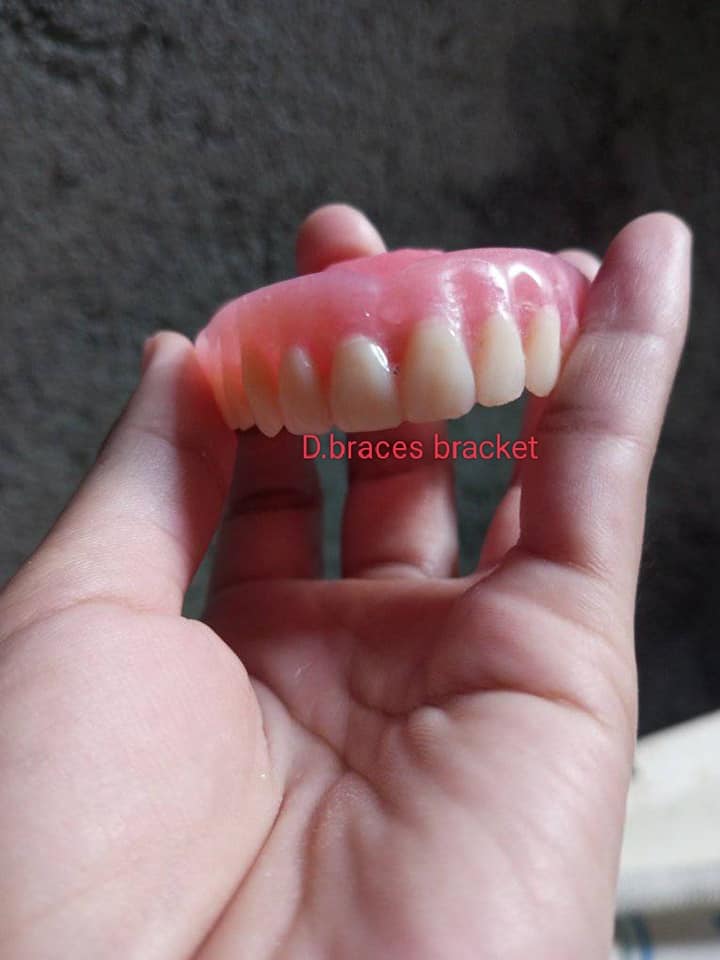 POSTISO PERO DI HALATA 🦷 SA... - Aesthetic Smile Dental Tech. | Facebook